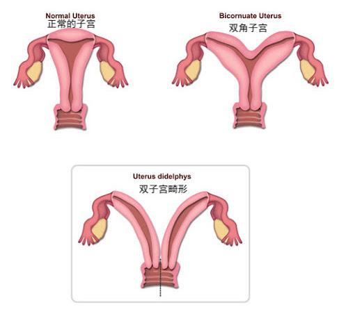 女人一个月两次月经，生理现象的深度解析